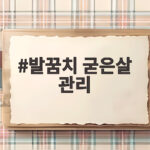 발꿈치 굳은살 관리로 매끄러운 발 만들기 발꿈치 굳은살 관리